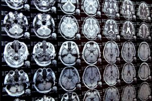 New AI system could accelerate clinical research | MIT News