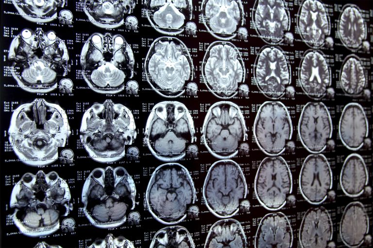 New AI system could accelerate clinical research | MIT News